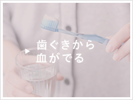 歯ぐきから血が出る方はこちら